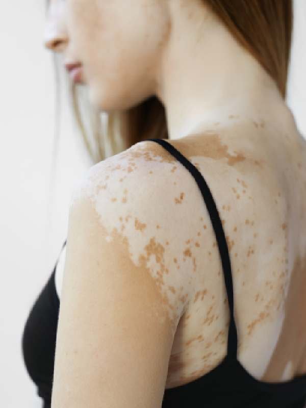 dr.leecoderma leeoderma